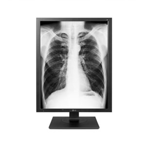 LG 의료용 모니터 (21HK512D)