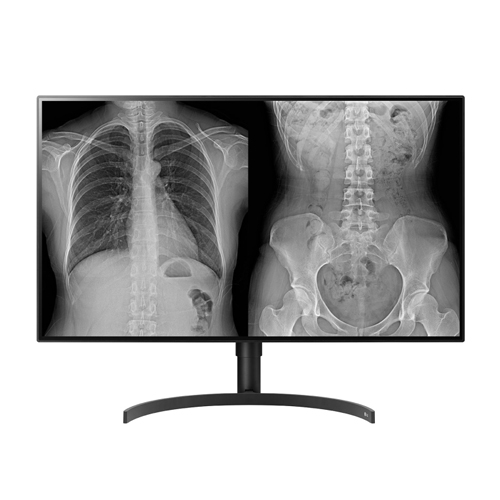 LG 의료용 모니터 판독/진단용 (32HL512D)